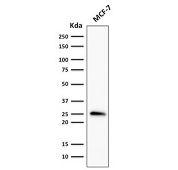 Bcl-2 Antibody