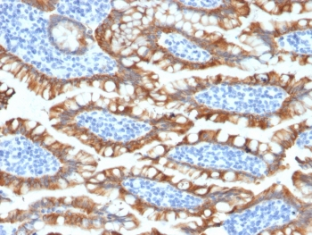 KRT8 Antibody / Cytokeratin 8