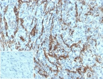 NGF Receptor Antibody / p75NTR / CD271