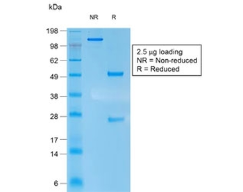 KRT10 Antibody / Cytokeratin 10