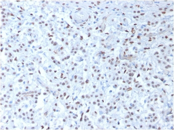 WT1 Antibody / Wilms Tumor 1
