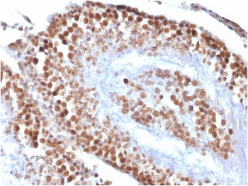 WT1 Antibody / Wilms Tumor 1
