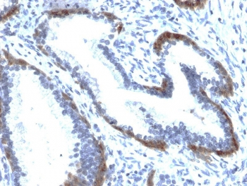 KRT15 Antibody / Cytokeratin 15