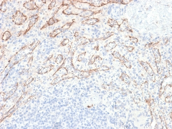 TNFSF15 Antibody / VEGI / TL1A