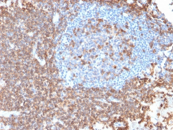CD43 Antibody