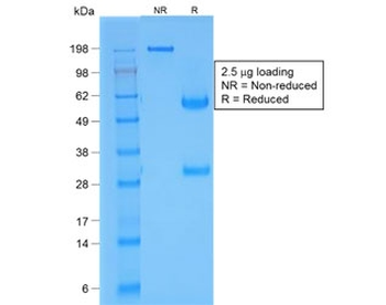 NKX2.1 Antibody / TTF-1