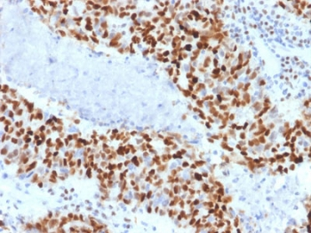 Cyclin E1 Antibody / CCNE1