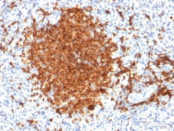 CD22 Antibody