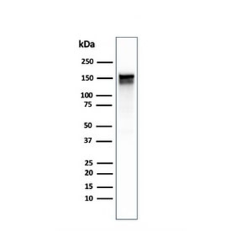 EGF Receptor / EGFR Antibody