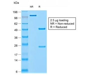 Chromogranin A Antibody