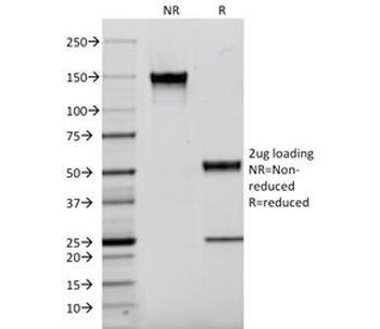 IBA1 Antibody / AIF-1