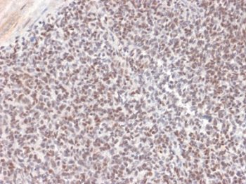 ALK Antibody / Anaplastic Lymphoma Kinase