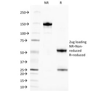 ALK Antibody / Anaplastic Lymphoma Kinase