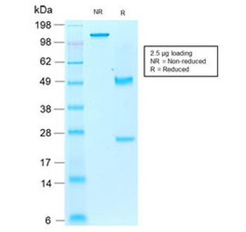 IBA1 Antibody / AIF-1