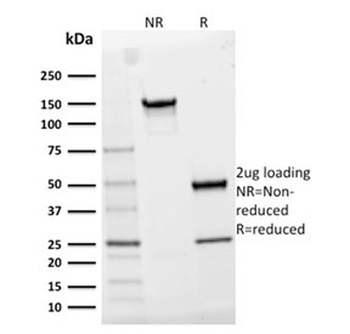 CD25 Antibody / IL2RA