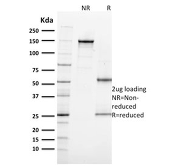 Ki67 Antibody