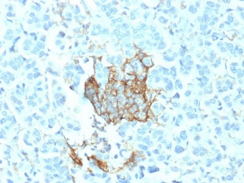 NGF Receptor Antibody / p75NTR / CD271