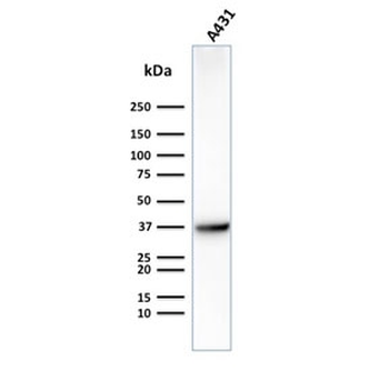 GLUT1 Antibody / SLC2A1