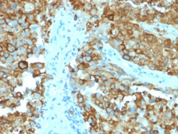 PMEL17 / Melanoma gp100 Antibody