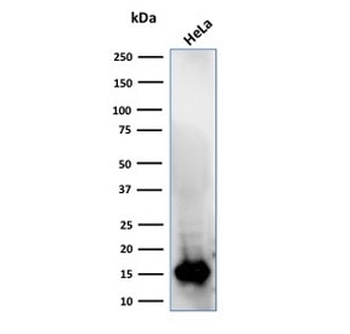 FABP5 Antibody (epidermal)