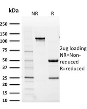 AKR1B1 Antibody / Aldose reductase