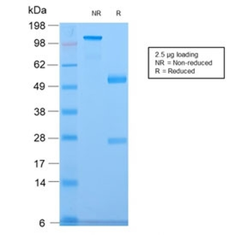 CELA3B Antibody / Elastase 3B