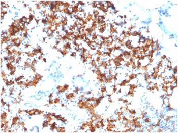 IL3RA Antibody / CD123