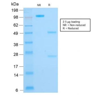 KRT16 Antibody / Cytokeratin 16