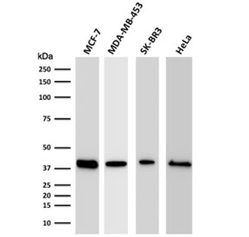 RPSA Antibody / 40S Ribosomal protein SA