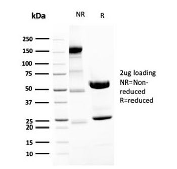 Neurofilament Antibody (-Heavy) / NF-H / NEFH