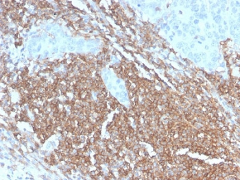 CD45RB Antibody (B-cell marker)