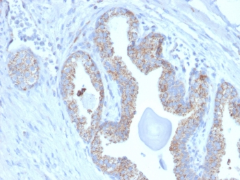 TMEPAI Antibody / PMEPA1