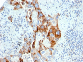 TMEPAI Antibody / PMEPA1