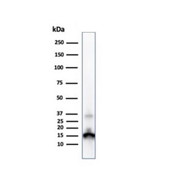 TTR Antibody / Transthyretin / Prealbumin