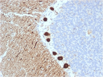 CA8 Antibody / Carbonic Anhydrase VIII