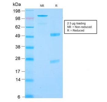 CA9 Antibody / Carbonic Anhydrase IX