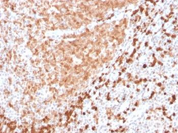 TCL1 Antibody