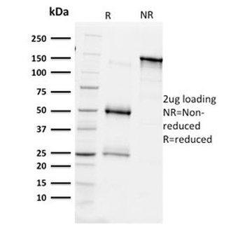 BAP1 Antibody / BRCA1-Associated Protein 1