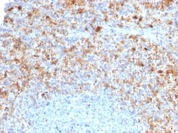 CD40L Antibody / TRAP / CD154