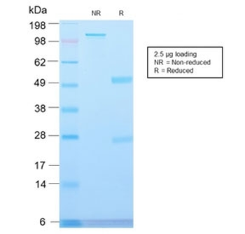 MVP Antibody / Major Vault Protein