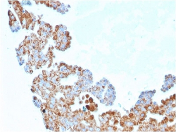 CDC34 Antibody / UBC3B