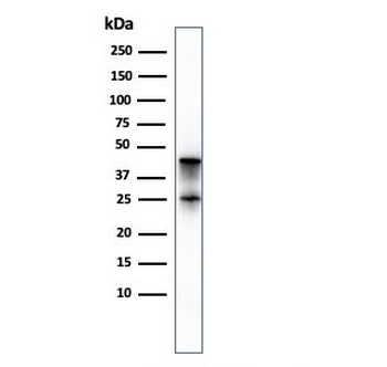 Carboxypeptidase A1 Antibody / CPA1