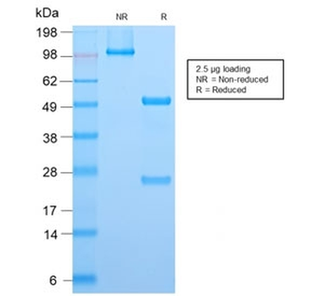 ALK Antibody / Anaplastic Lymphoma Kinase