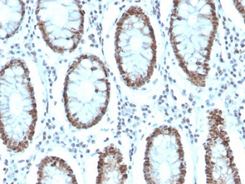 MSH6 Antibody