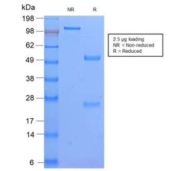HLA-DPB1 Antibody (MHC II)