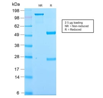 Kappa Light Chain Antibody