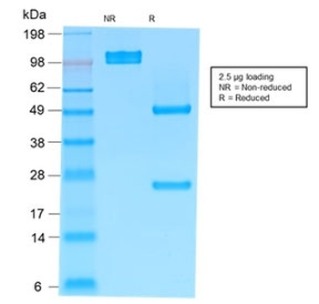 IgM Heavy Chain Antibody