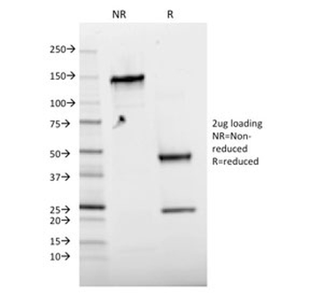 Phospho-JUN Antibody (pT91/93)