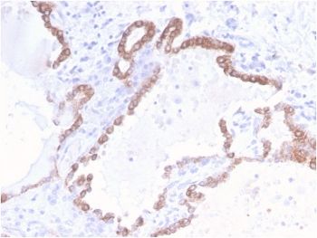 Cytokeratin 18 Antibody