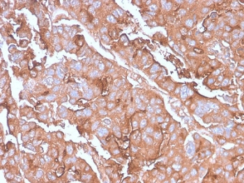 MUC1 Antibody / Mucin-1